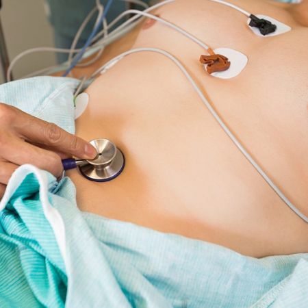 EKG Elektrokardiogram (merjenje električne aktivnosti srčnega utripa med naporom)